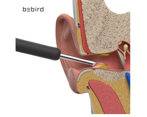 Эндоскоп для удаления ушной серы (Bebird R1)